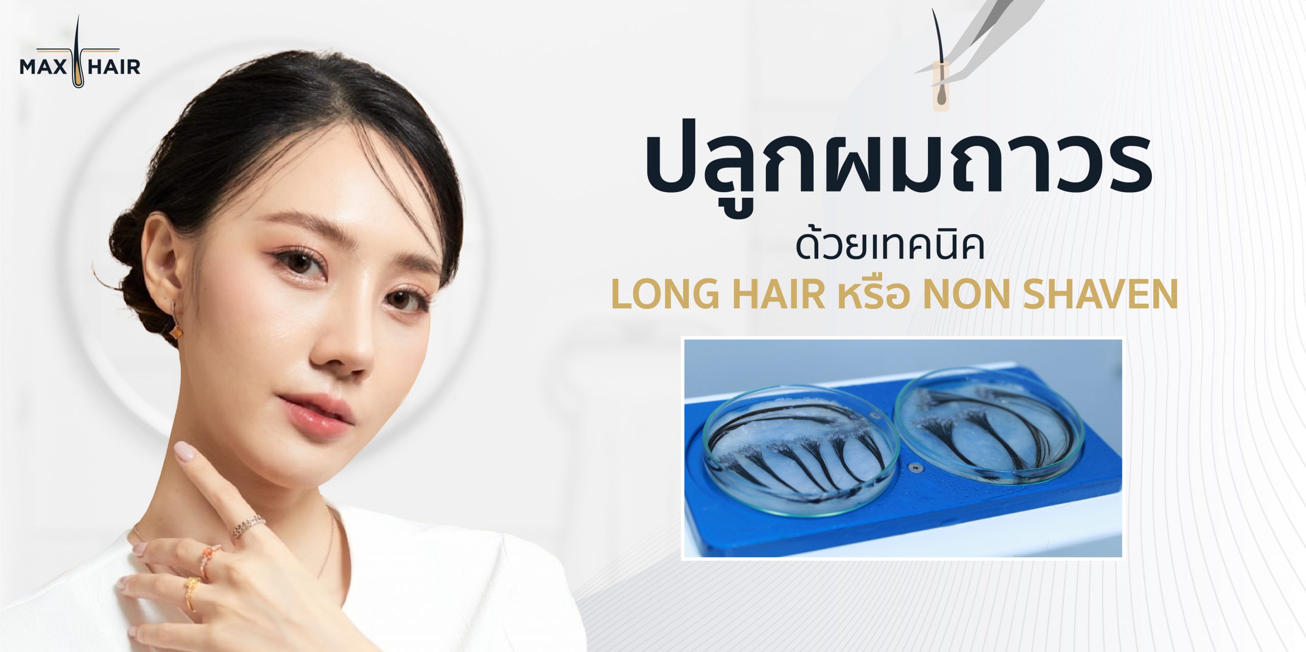 การปลูกผมถาวรด้วยเทคนิค Non Shaven FUE