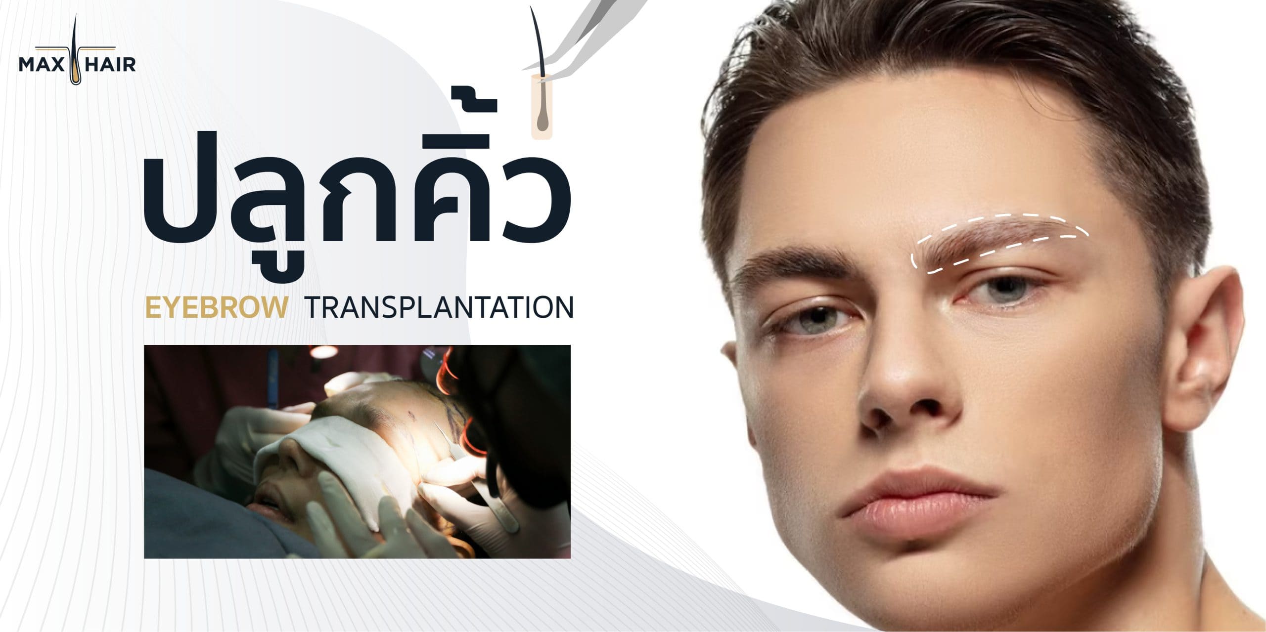 บริการปลูกคิ้วทั้งผู้หญิงและผู้ชายที่ MAX-HAIR