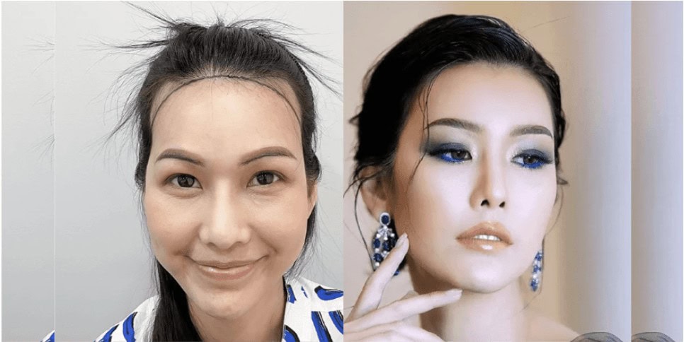 รีวิวการปลูกคิ้วถาวร เพิ่มความมั่นใจให้นักแสดงสาว