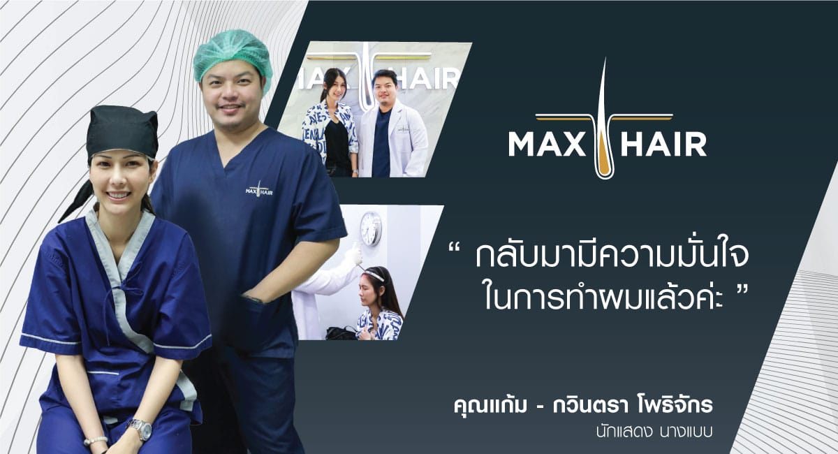 คุณแก้ม กวินตรา นักแสดง เข้ารับบริการปลูกผมที่ Max Hair Clinic