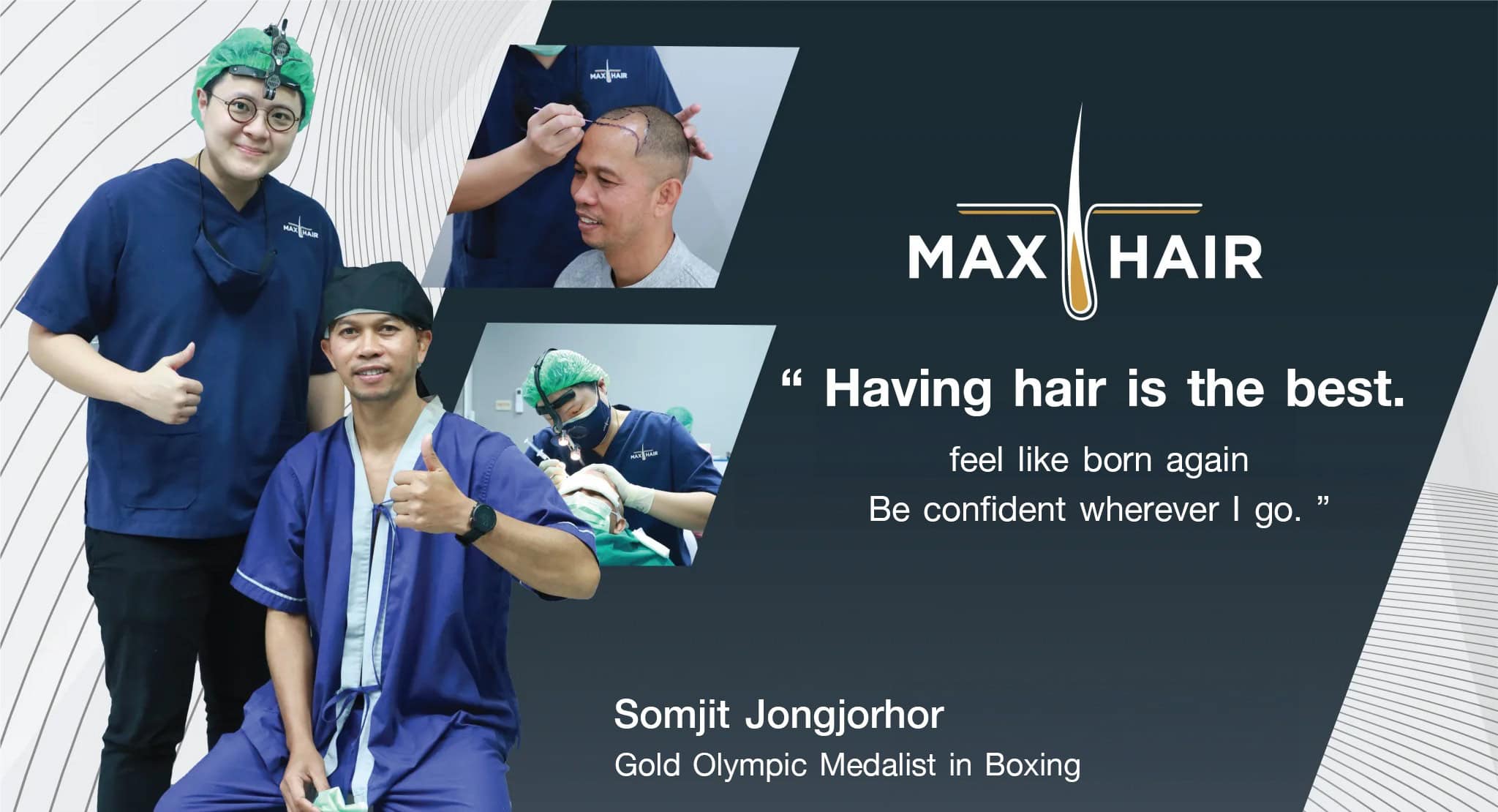 Hair transplant review - Somjit Jongjorhor (Gold Olympic Medalist in Boxing)