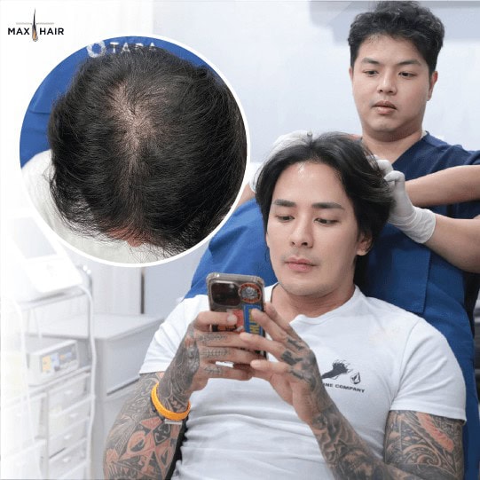 ผมร่วงเกิดจากหลากหลายสาเหตุ แตกต่างกันไปในแต่ละบุคคล