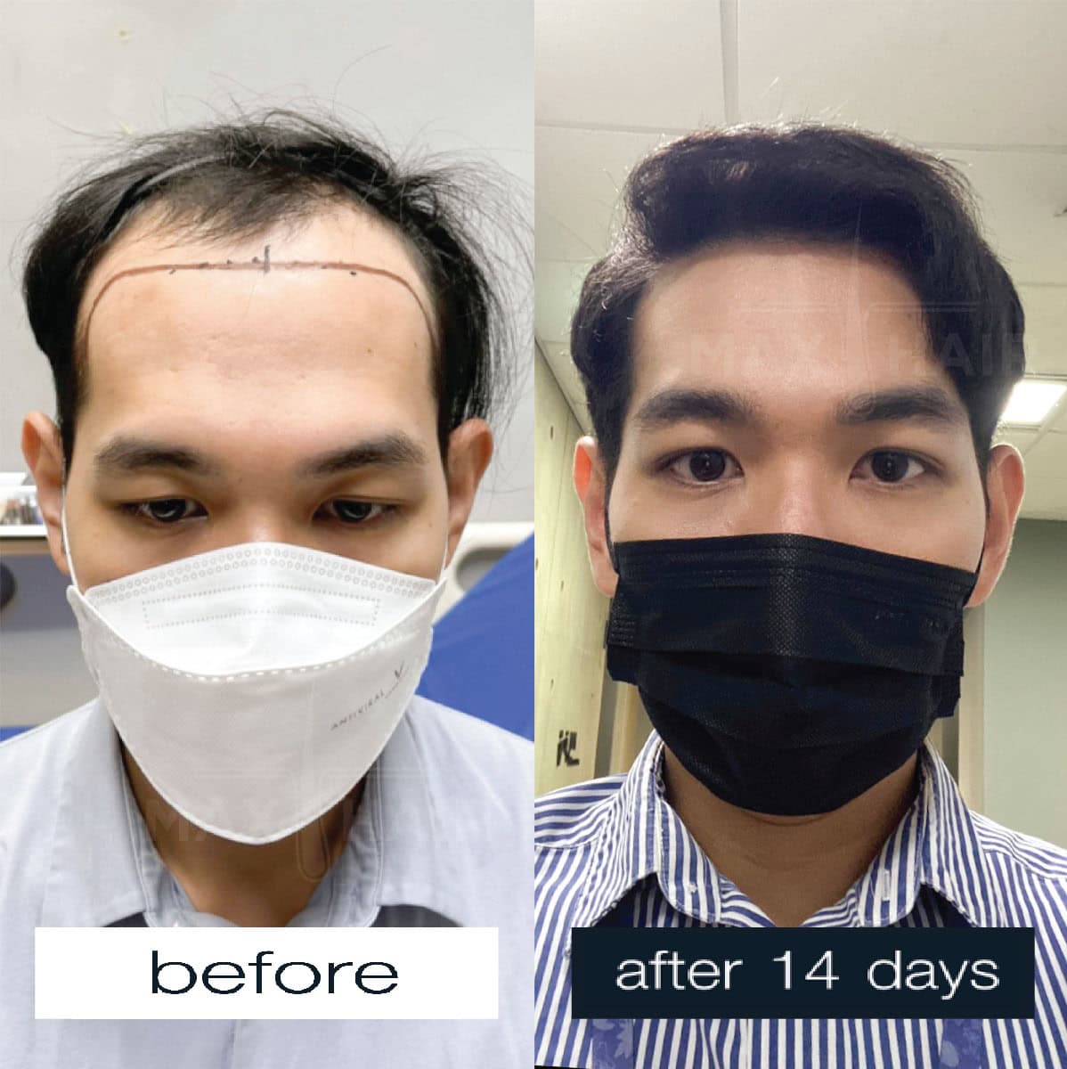 Case Review Men (1)