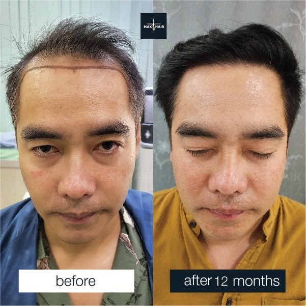 Case Review Men (2)