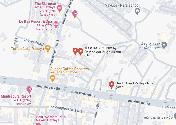 ที่ตั้ง Max Hair Clinic สาขาหาดใหญ่