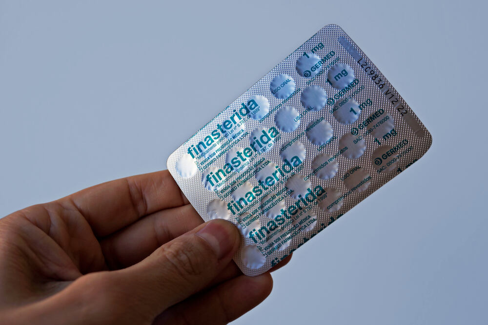 Finasteride ยาปลูกผมที่ได้รับความนิยมที่สุด