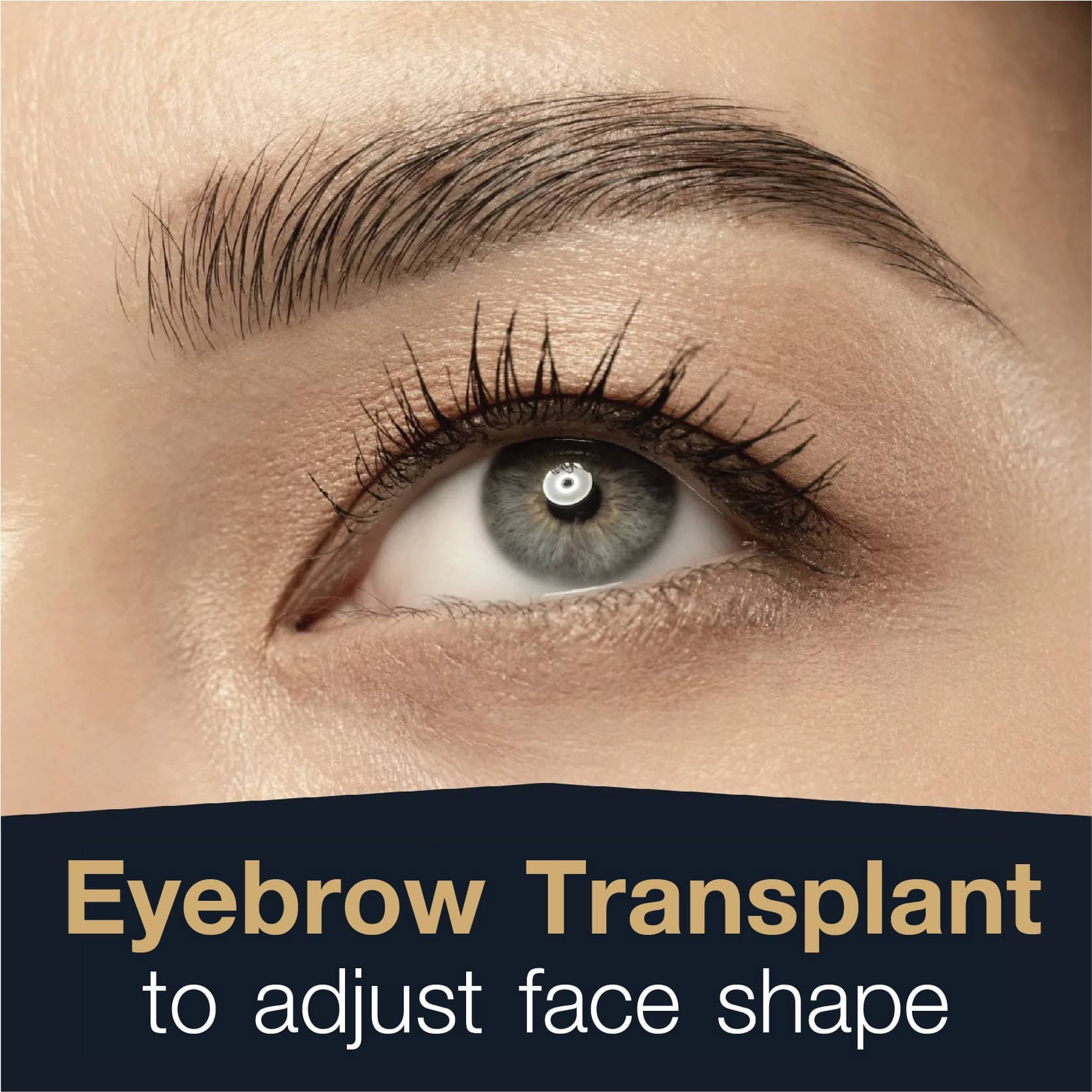 Eyebrow Transplant to adjust face shape
