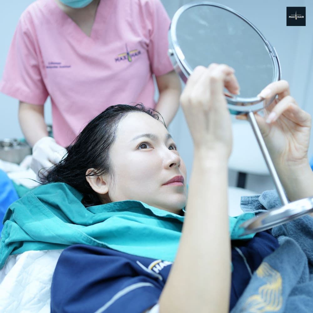การปลูกผมด้วยเทคนิค Long Hair ที่ Max Hair Clinic