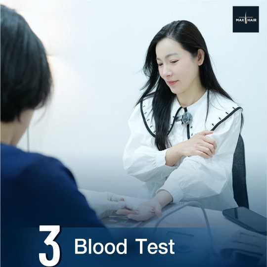 Blood Test for Hair Transplant Patients