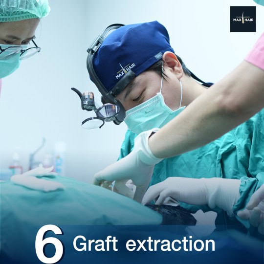 Close up of doctor at Max Hair Clinic in Thailand doing a graft extraction