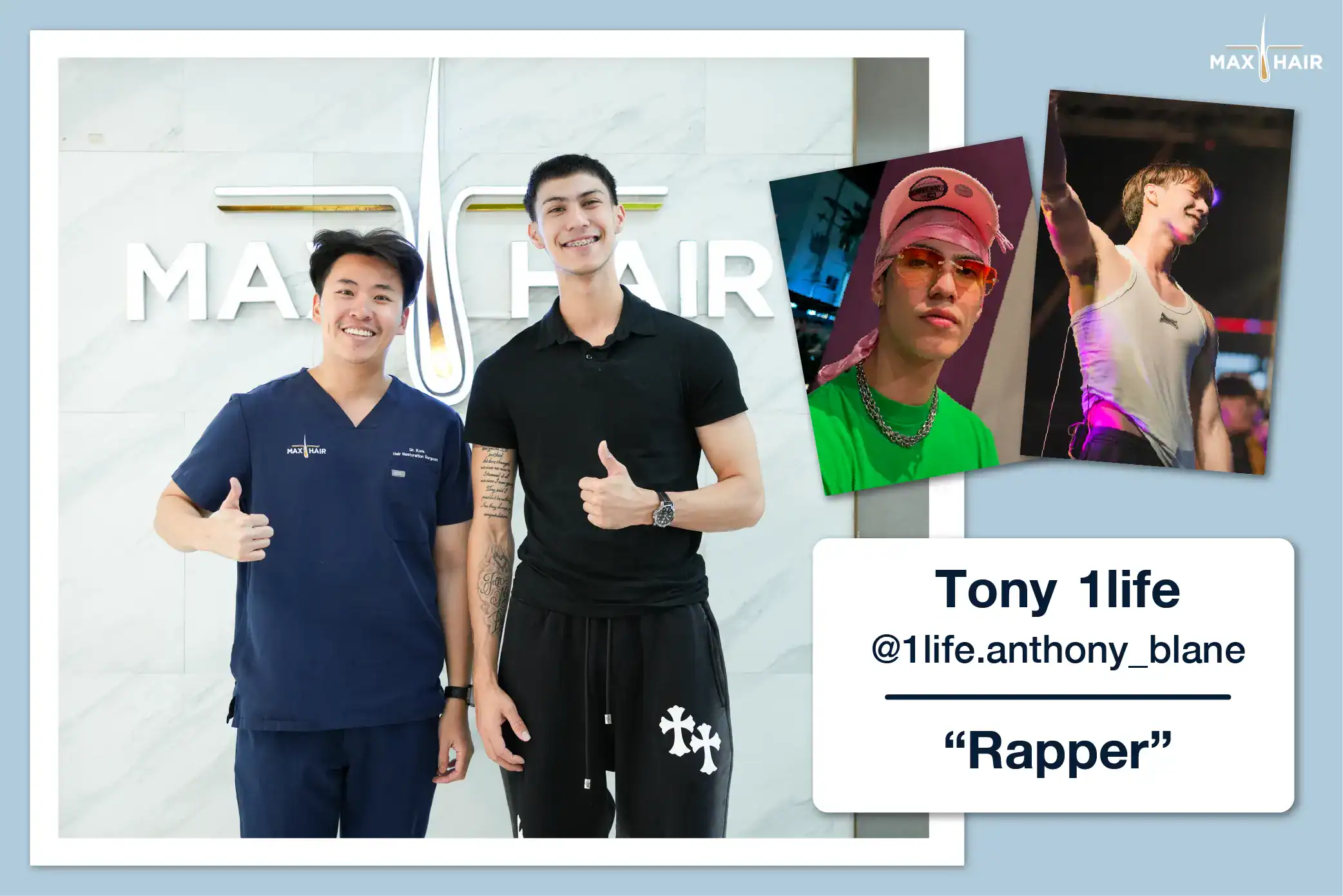 Hair Transplant Review Case: Tony 1life