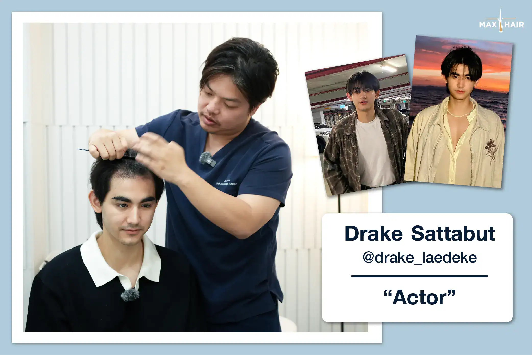 Hair Transplant Review Case: Drake Sattabut