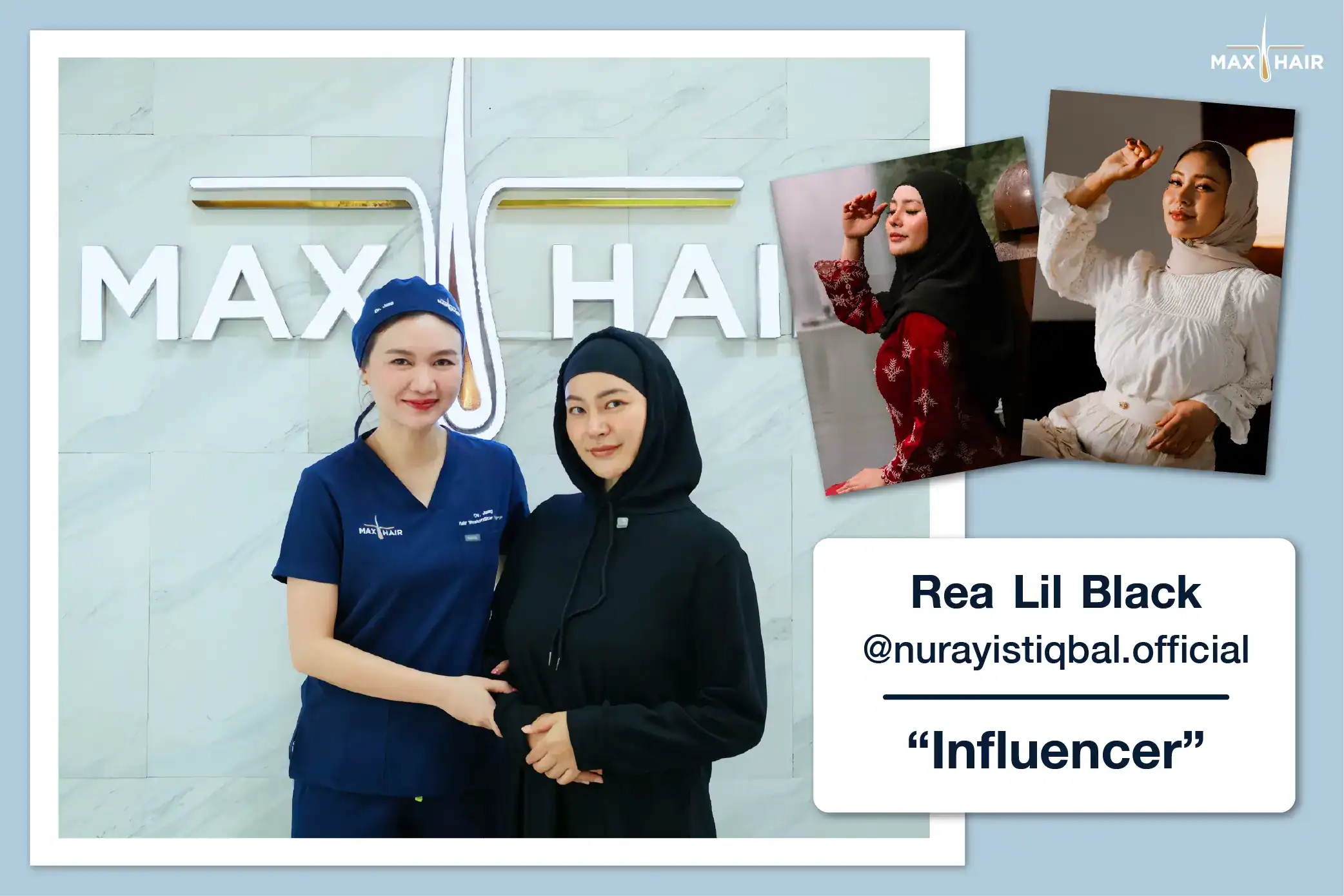 Hair Transplant Review Case: Rea Lil Black