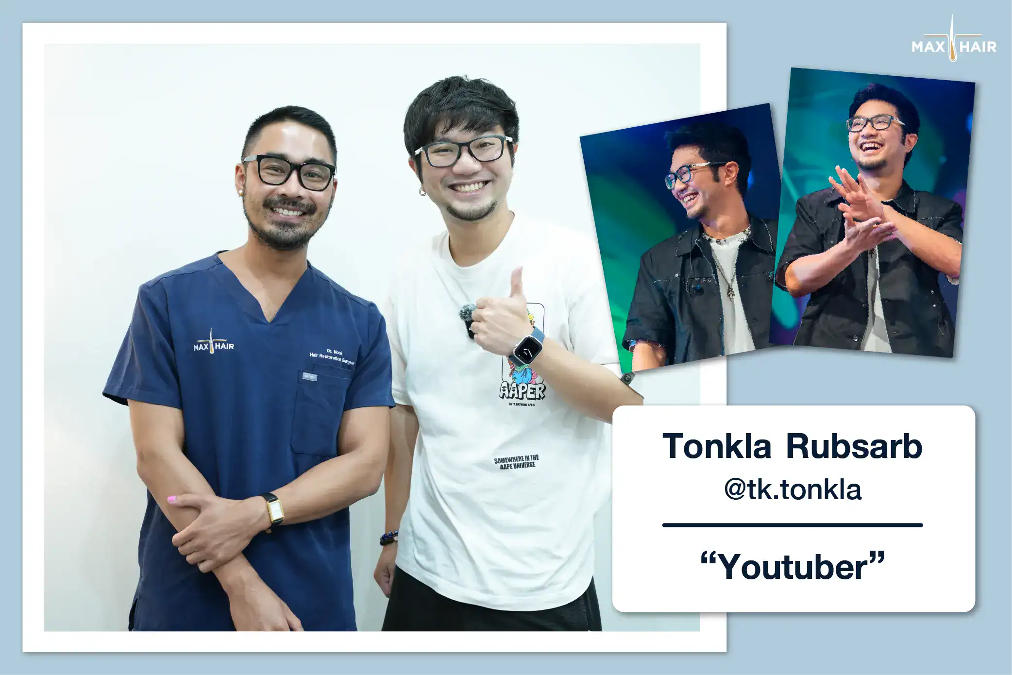 Hair Transplant Review Case: Tonkla Rubsarb