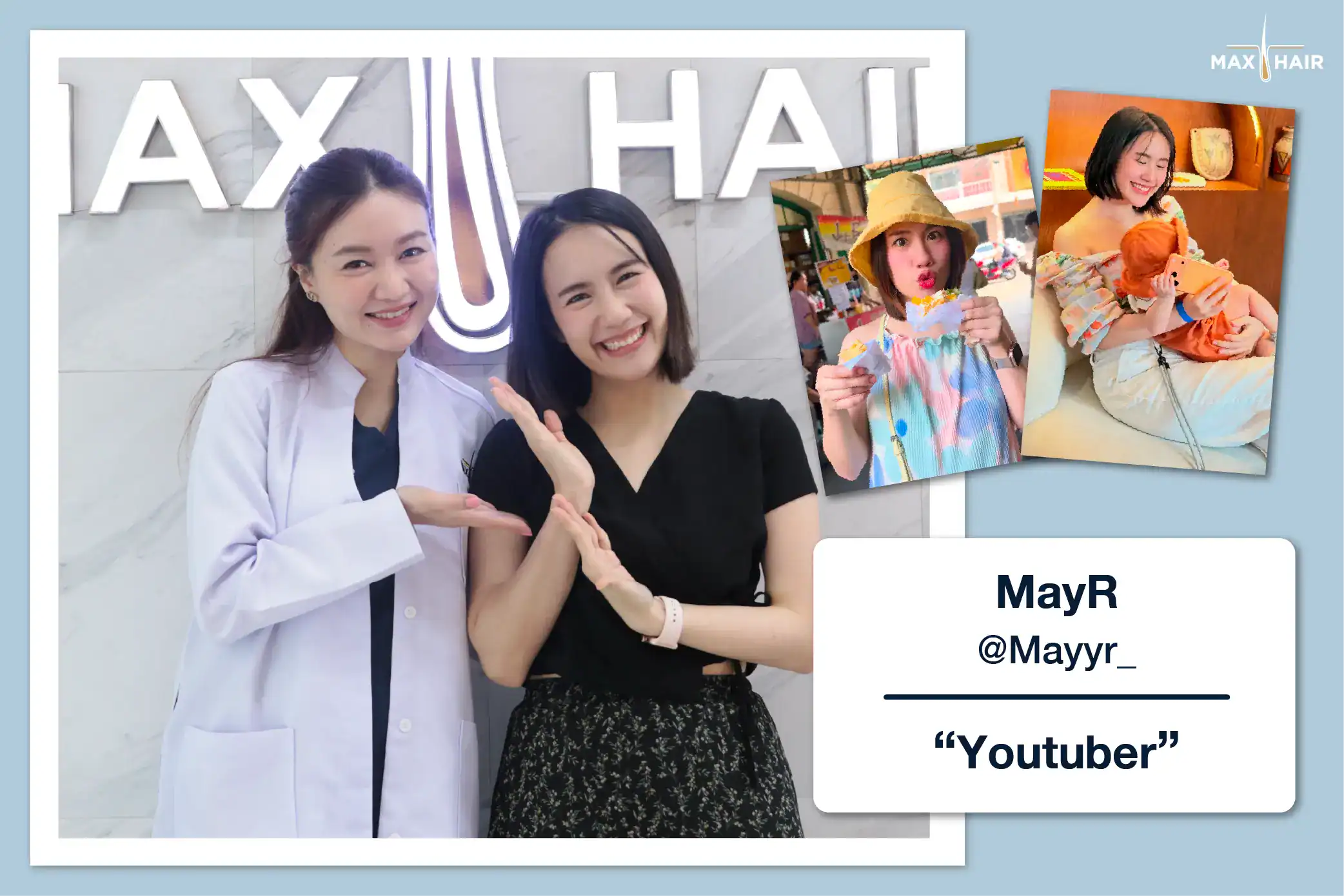 Hair Transplant Review Case: MayR