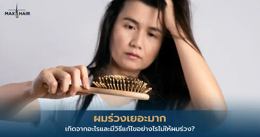 ผมร่วงเยอะมาก