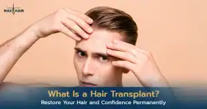 Hair Transplant