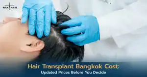 Hair Transplant Bangkok Cost