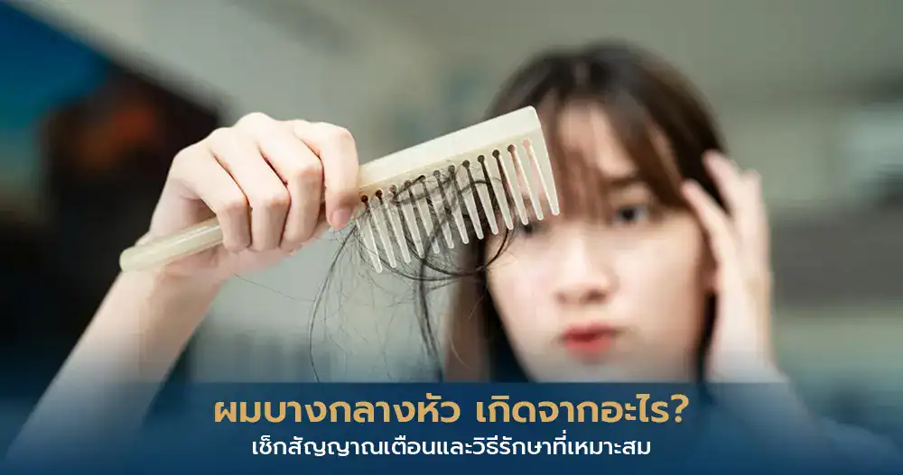ผมบางกลางหัว