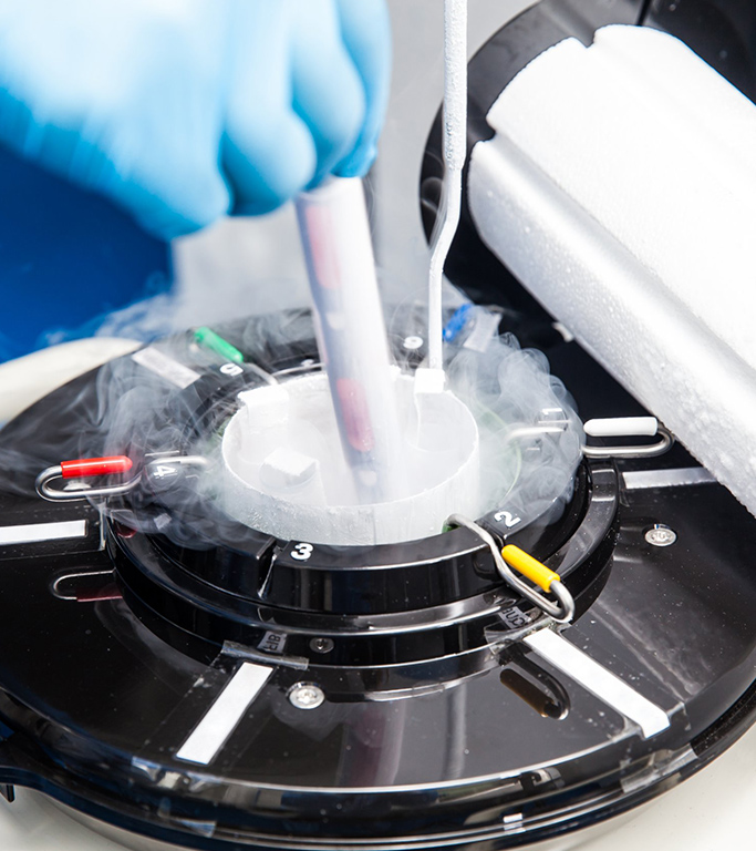 Laboratory technician performing embryo cryopreservation process.