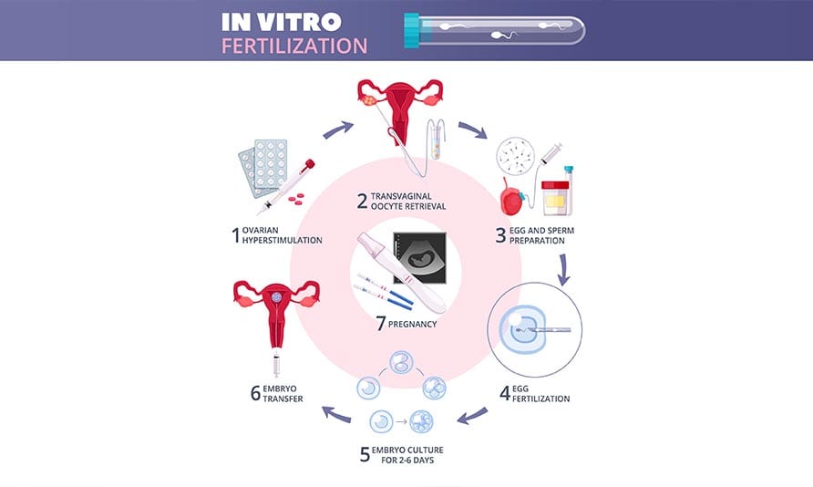 Understanding IVF Procedure and Treatment Costs in Delhi: A Comprehensive Guide