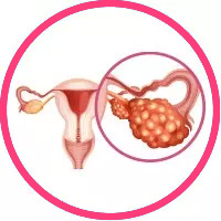 Best IVF Centre in Delhi with High Success Rate - Nandi IVF