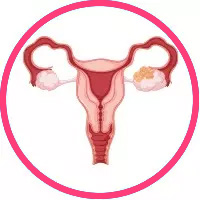 Best IVF Centre in Delhi with High Success Rate - Nandi IVF
