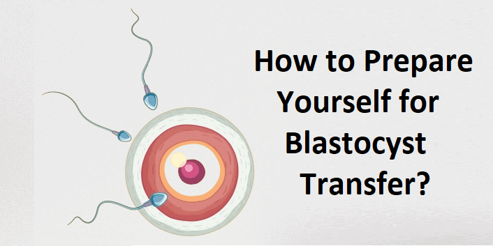 Illustration of blastocyst transfer process for IVF treatment.