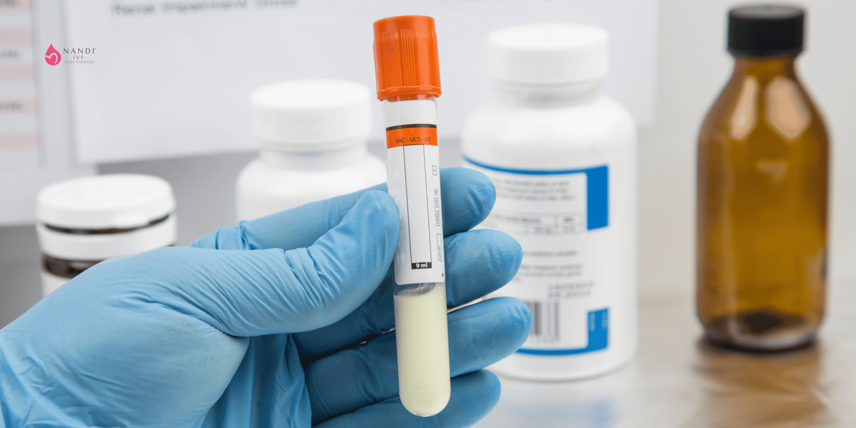 Laboratory test tube with semen sample for IVF analysis.