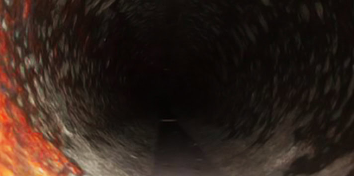 Pipeline inspection and remediation operations