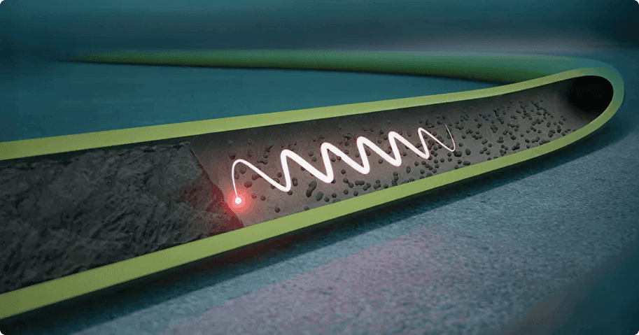 Find-Block technology for accurate blockage location