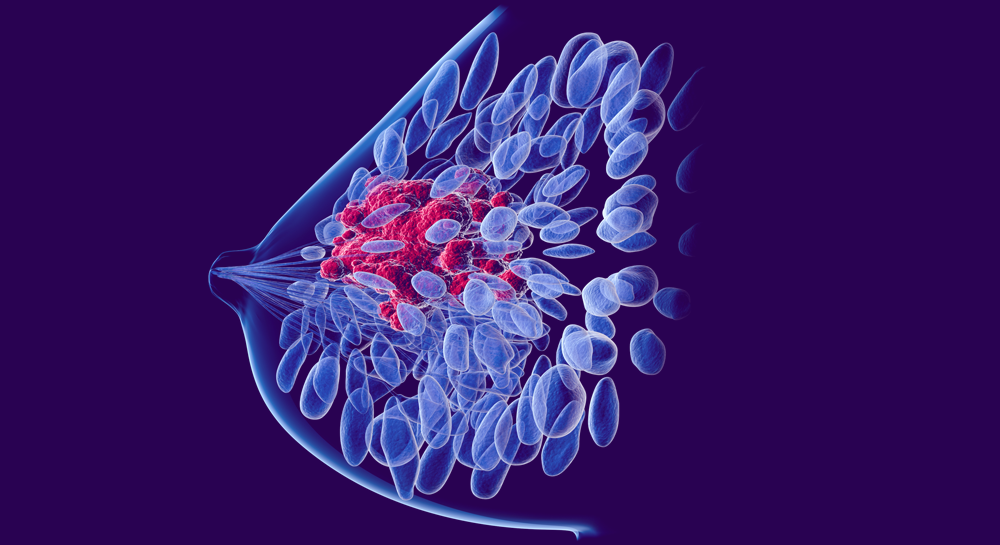 Nanotechnology targets cancer through breast ducts