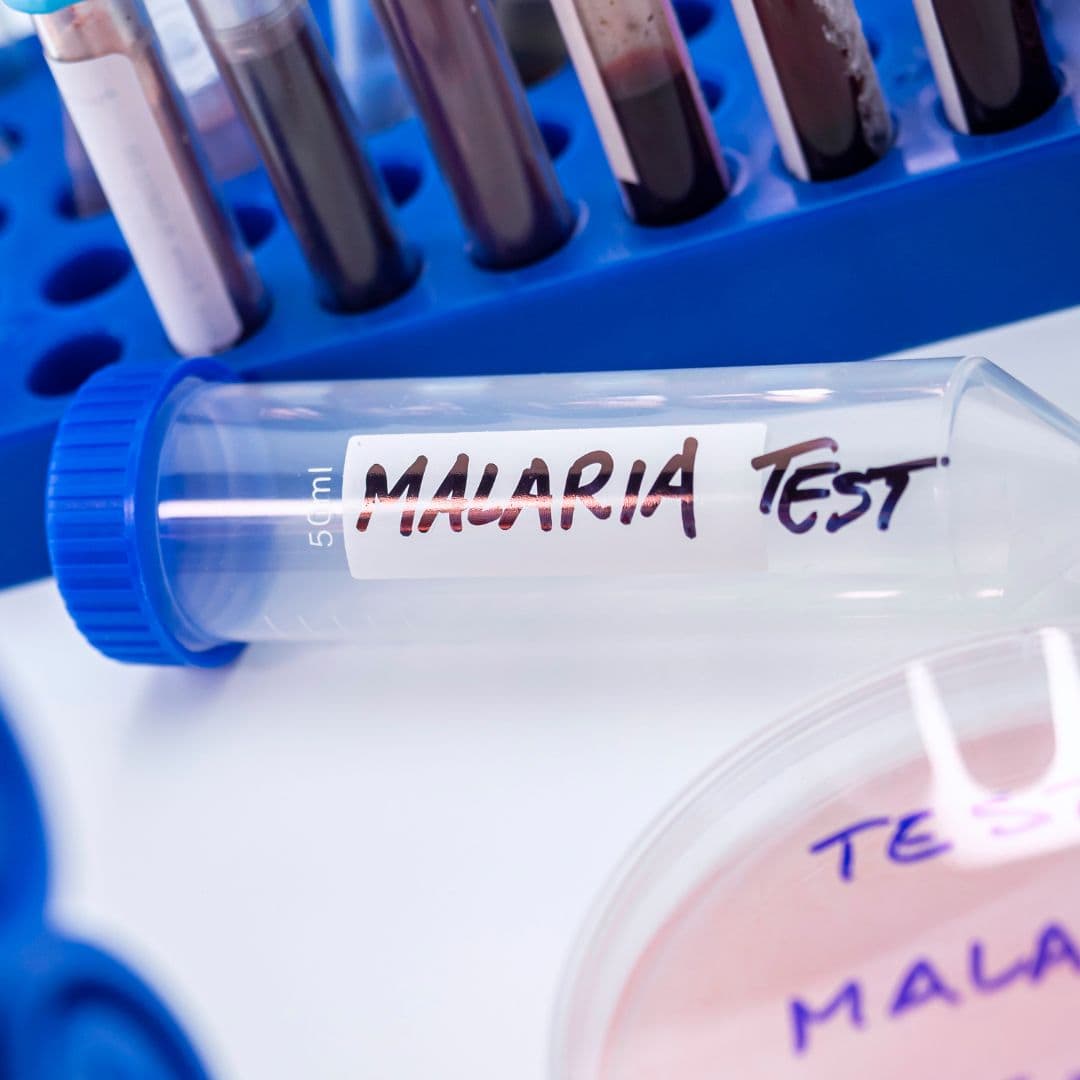 Facts about malaria and common myths
