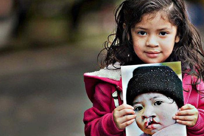 operation-smile operation-smile