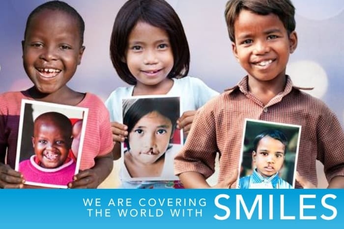 operation smile UAE operation smile UAE