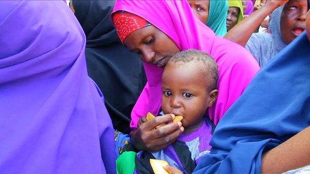 Child receiving nutritional aid in Somalia, highlighting urgent need to address chronic malnutrition.