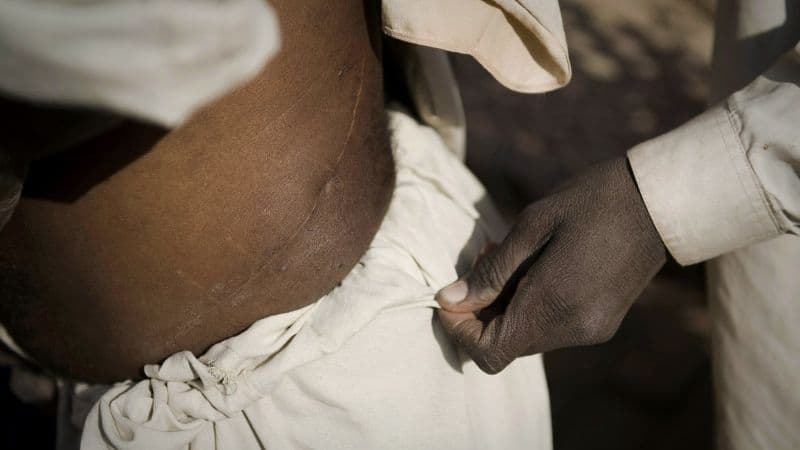 Impoverished Young Men in Kenya are Selling their Kidneys in Return for Cash to Start their Own Businesses