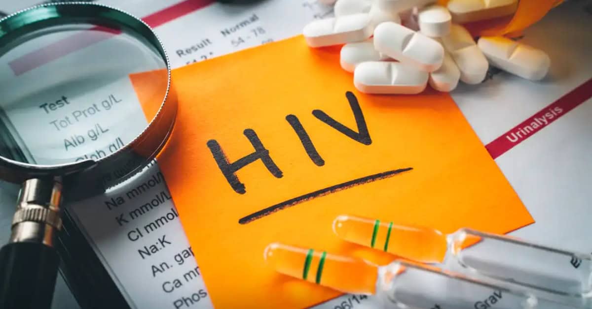 HIV testing kits, pills, and lab results for HIV management.