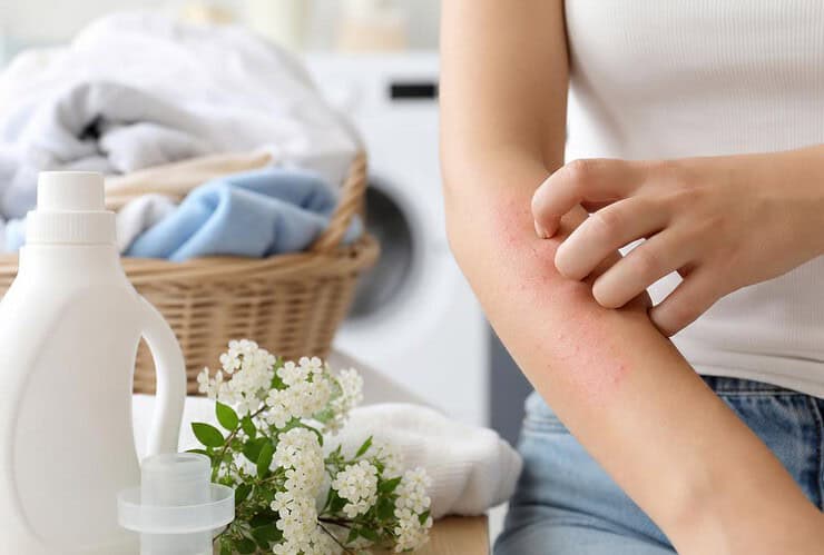 bouton d allergie lessive