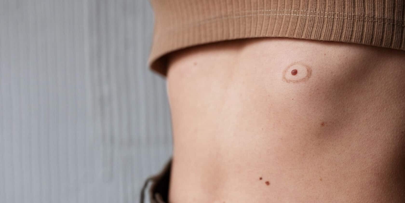 red mole