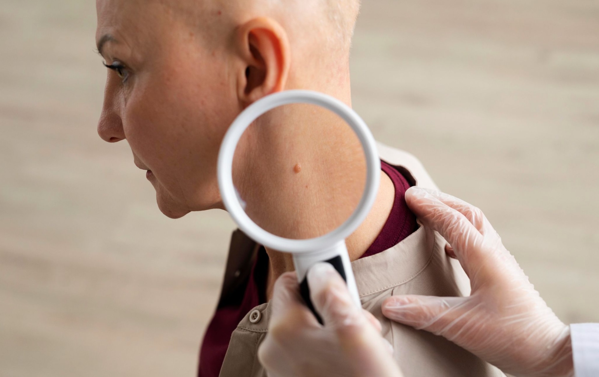 sudden skin tags growth on the body