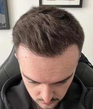 Danny-After
