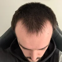 Danny-Before-2