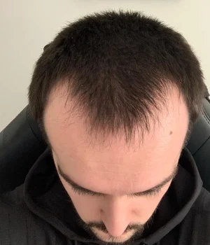 Danny-Before-2