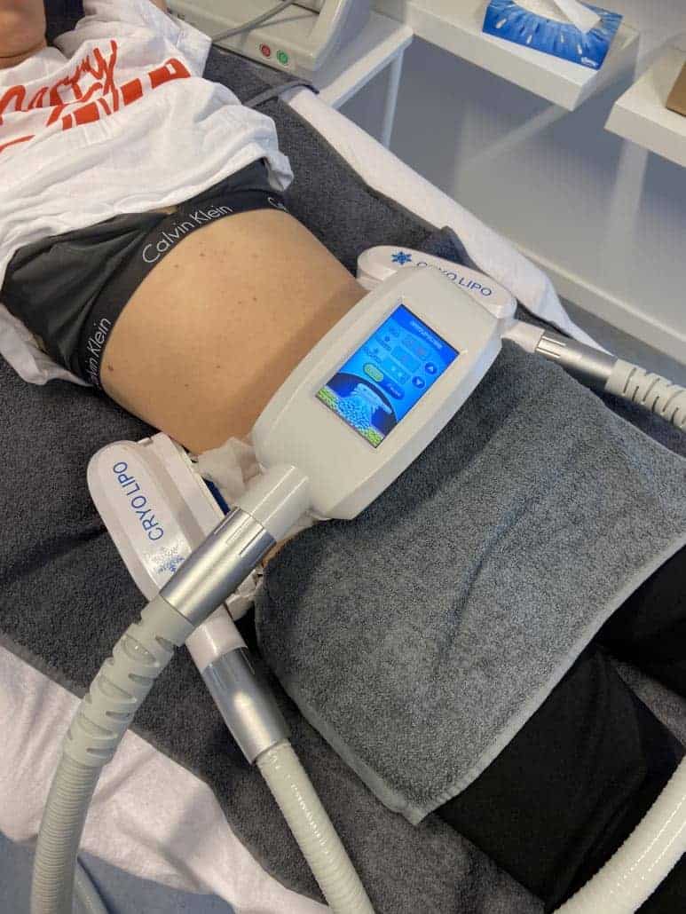 fedtfrysning af mave med maskine