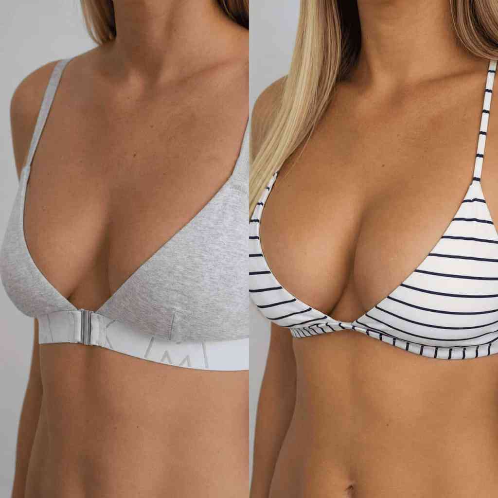 Prima e dopo un lipofilling mammario con aumento naturale del volume del seno.