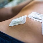 Douleur dans le bas du ventre après ligature des trompes