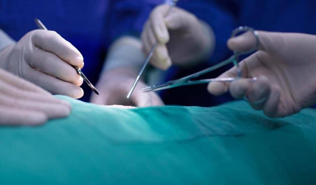 Douleur dans le bas du ventre après ligature des trompes opération