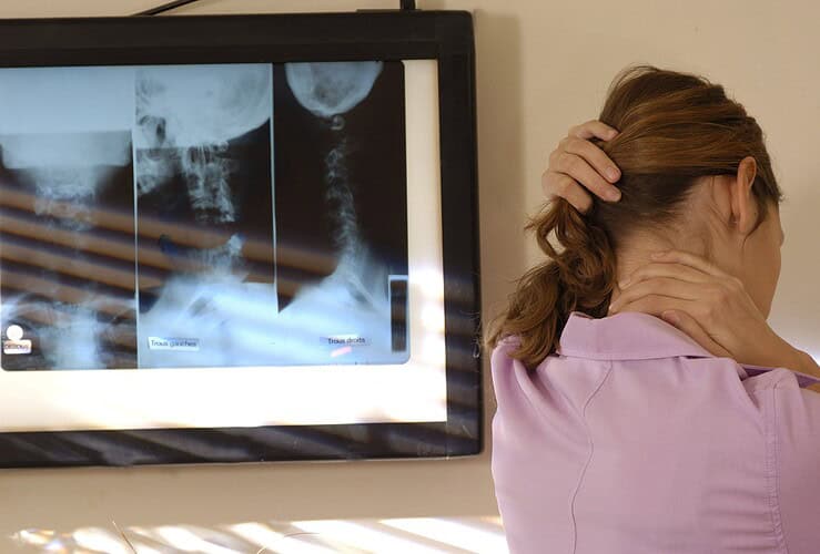 Fibromyalgie et travail debout