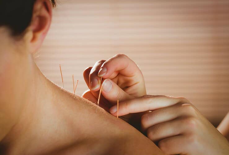 Points d'acupuncture contre les vertiges